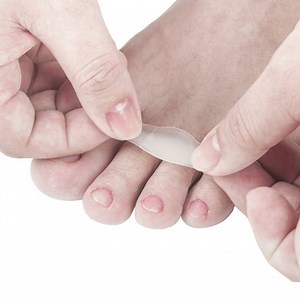 How To Use A Hydrocolloid Dressing... Properly!