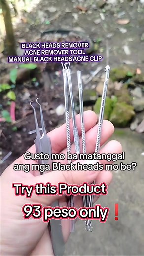 Ang satisfying shems #tweezers #whiteheadremoval #satisfying #satisfyingwhiteheadsremoval