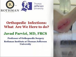 Opening Presentation - Javad Parvizi MD