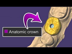 Implant Crown Tutorial 2025 EXOCAD