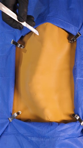 Trying out a surgery simulation for fun | 5-Minute Crafts