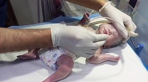 Critical Newborn Care After Delivery TTN & Meconium Aspiration Management|Deep Suction,RBS & IV Line #feedshorts #preemiebab #NewbornJoy #baby #cutebaby #softbones #newbornbaby #babycrying #hungry #newborn | Anoop Gautam