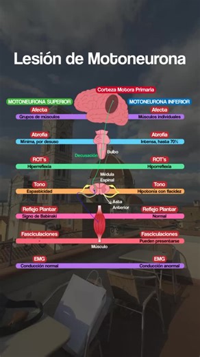 6.2K views · 1.4K reactions | 易Hablando de Lesiones de Motoneurona,...