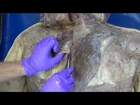 From Grant’s Dissection Video Collection: Superficial Muscles of the Back