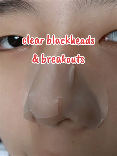 solution to clear blackheads and breakouts with ClearUp Clarity Nose Strip #blackhead #breakout #skincare #nosestrip #tips
