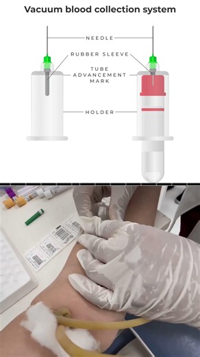 Blood Collection Tube & Needle 💉 | Phlebotomy Technique Explained