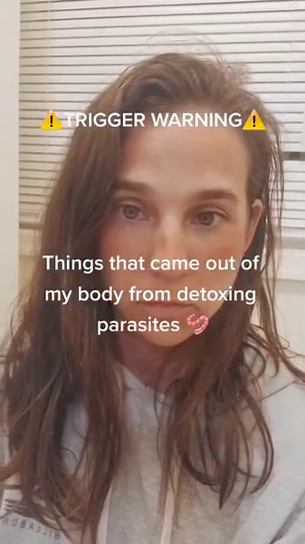After removing these critters my histamine issues went away (allergies, food sensitivities, chemical sensitivities, itchiness, rashes, seasonal allergies). Yes you have these too! . . . Comment WORM below 👇🏼 for link to my favorite parasite cleanse to get rid of these critters too! . . . #parasites #parasitecleanse #parasitesymptoms #parasitedetox #holistichealth #rootcausemedicine #nursepractitioner #eczema #RootCauseHealing #naturalhealing #holistichealing #itchiness #histamineintolerance #h