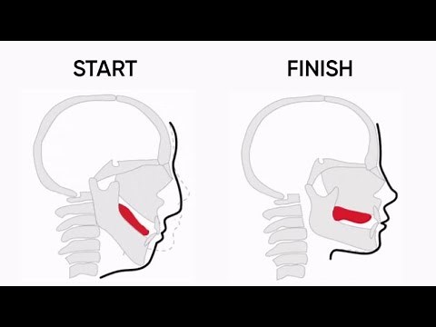 Step by Step Guide on How to Mew