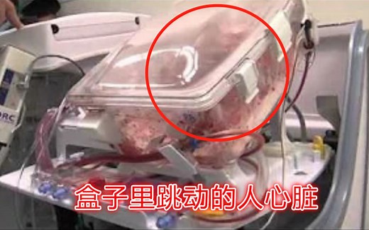 脱离人体仍能跳动的心脏~实拍活体心脏移植手术全过程