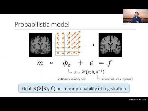Deep Learning Image Registration and Analysis - Lecture 21 - MIT ML in Life Sciences (Spring 2021)