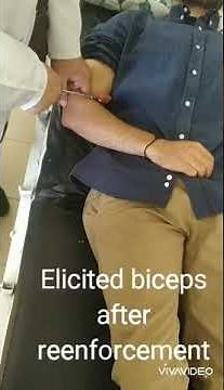 Neurological signs: Biceps reflex example 2
