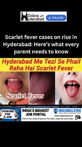 300K views · 294 reactions | Hyderabad is witnessing a rise in cases...