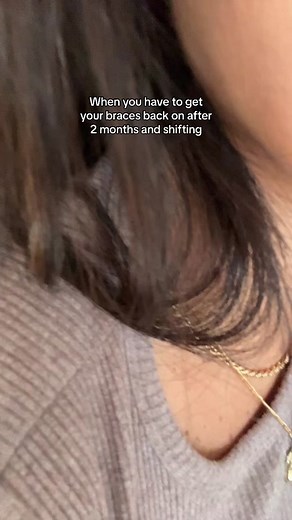 Shifting Bottom Teeth Braces Journey After 2 Months