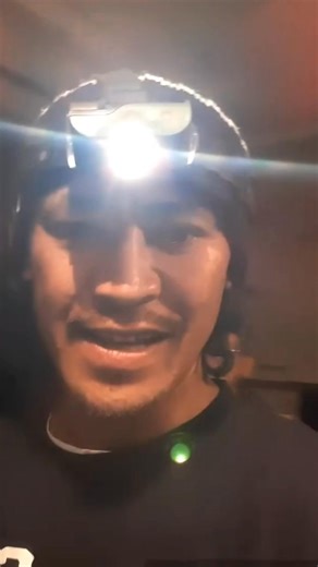 The day I stapled my dad's eye, with the same staple gun that's used the staple up pig hunting dogs 😂🤦🏾‍♂️ | J DUBB