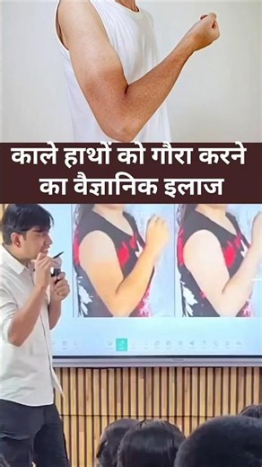 काले हाथों को गौरा करने का इलाज 😱😮 #facts #information #education #knowledge #fact #health