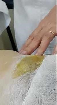 Uruguay. Hair Removal (Full Bikini)