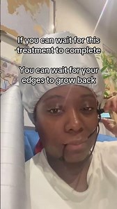 Let’s grow your edges back together #shbhaircare #hibiscus #haircare #hairgrowth #edges