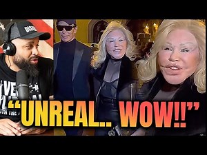 Plastic Surgery Disaster But She Thinks She looks Good 🤯