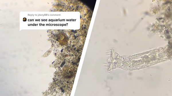 Exploring Rotifers Under the Microscope