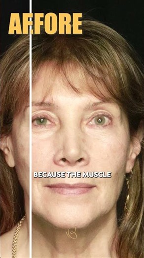 Dr. George Orloff | Can a Blepharoplasty help with your vision?