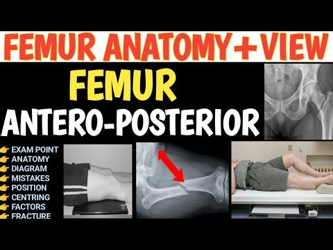 Femur AP X-Ray | Radiography Positioning Step by Step | Antero-Posterior view of Femur Positioning