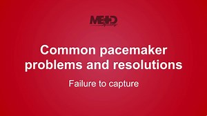 In today’s teaching video, British pacemaker expert Kristian Webb will explain what failure to capture is, why it’s important that you know about it, possible causes and what to do about it. Find out more in our Pacemaker Essentials course: https://bit.ly/3dxyZ4h | Medmastery | Facebook