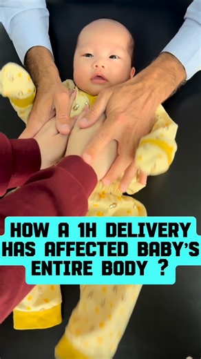 Nicolas Grimaldi on Instagram: "Birth is Nature’s way of preparing a baby for life outside the womb 🤰🏾 It’s a powerful process that stimulates the nervous system and reshapes the baby’s skull and spine — especially the neck and lumbar reflexes, which are vital for early movement and development. In a C-section, the baby misses much of this stimulation. While some adapt well, most show some level of imbalance, highlighting the body’s incredible plasticity but also its need for support. These im