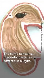 Developers hope their ‘slime robot’ will one day be used to help find items that have been swallowed by accident. https://bbc.in/3NLyV0H | BBC News India
