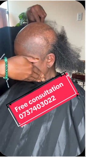 Alopecia Transformation Sew-In & Protective Styles — 50% Deposit