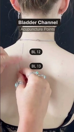 Needling Bladder Acupuncture Points #acupuncture