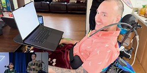 Patient of Elon Musk’s Neuralink Shows Off New Life With Implant