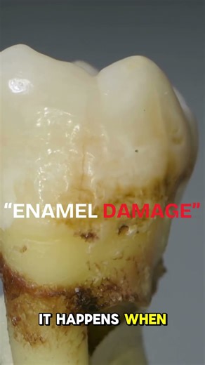 “Why Do My Teeth Feel Sensitive?” #dentisttips #dentalhygiene #smiledesigndental #dentist