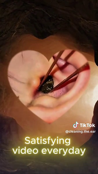 Cleaning the ear tube on TikTok