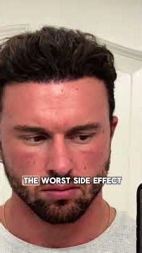 Kiierr Laser Cap Serious Side Effects - EXPOSED..