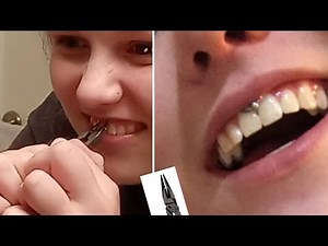 TAKING OUT MY SMILEY PIERCING (FRENULUM)