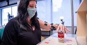 Spinal stimulation can improve arm and hand movement years after a stroke