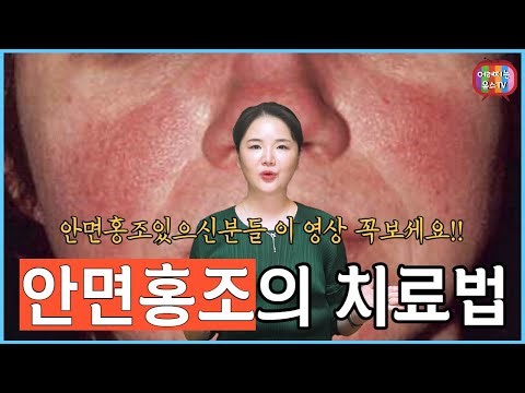 안면홍조 있으신분들 !! 이 영상 꼭보세요~!! 안면홍조의 치료법!!