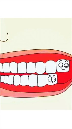 🦷 Fixing an Underbite: How it Works! (Animation) ✨ #shorts