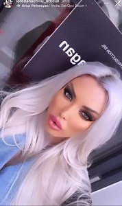 41 reactions | Russian lips for @loredanachivu_official Programări :0722296007 | Clinica Beauty Art Aesthetics | Facebook