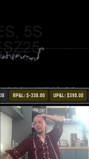 +$1000 in one TRADE in the TOPSTEP VIP