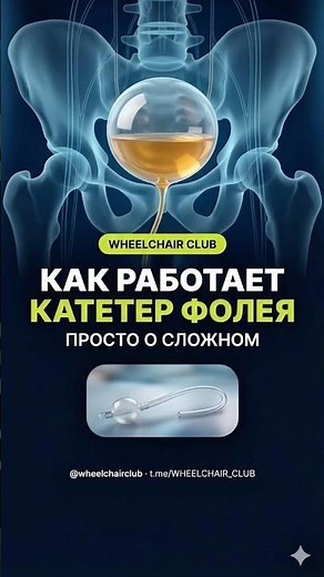 КАК РАБОТАЕТ КАТЕТЕР ФОЛЕЯ #колясочники #инвалиды #катетор #фолей