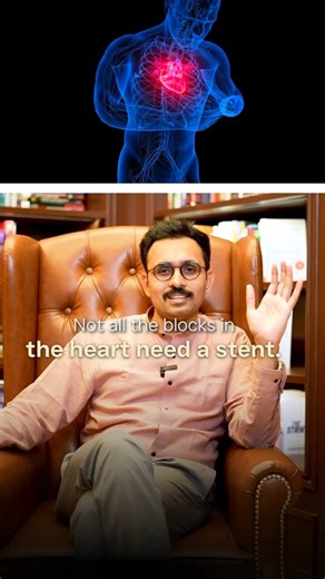 Dr. Aravind Duruvasal MBBS, MD, DM on Instagram: "Not every heart block needs a stent. Some can heal with medicine alone. Understanding borderline disease and using tools like Fractional Flow Reserve (FFR) helps doctors decide what truly requires!"