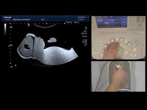 Knobology Part 1 (Basic B-mode Controls)