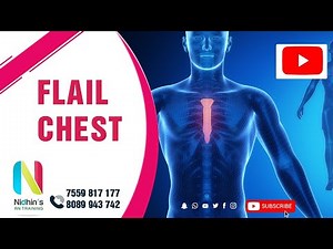 FLAIL CHEST #chest_injuries #trauma #hemothorax