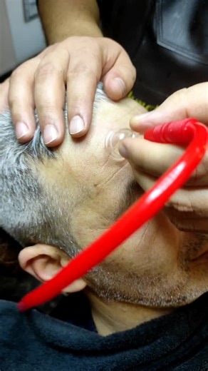 Ear Examination Techniques in a Clinical Setting