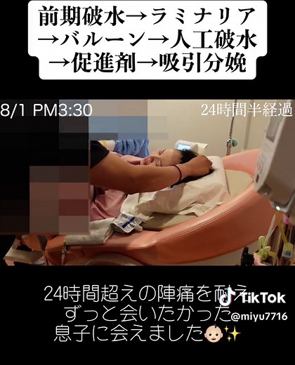 出産レポ🤰【みのりゆファミリー】で検索🔍#出産レポ#出産報告#出産シーン#陣痛#分娩#前期破水#ラミナリア#バルーン#人工破水#促進剤#吸引分娩