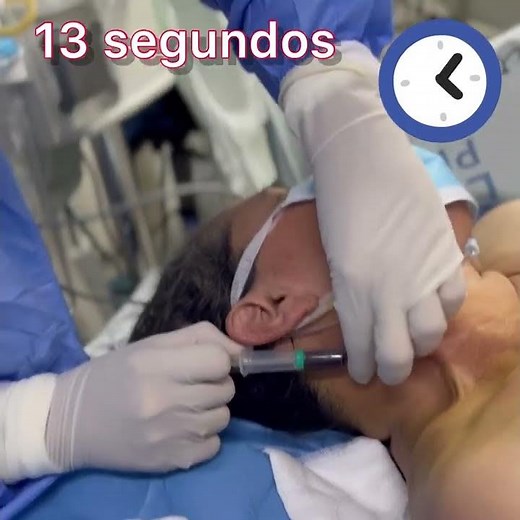 Abordaje de catéter venoso central, yugular posterior