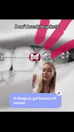 4 Things to Get Braces off Sooner