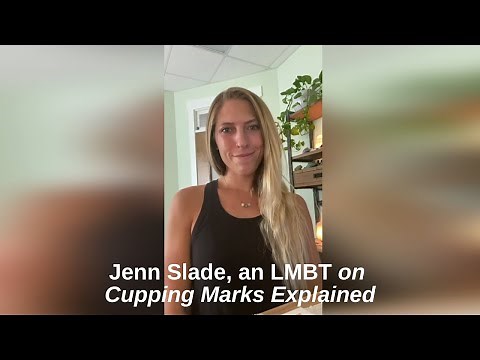 Unlocking the Mystery of Cupping Bruises: Meaning, Removal, and Benefits Explained