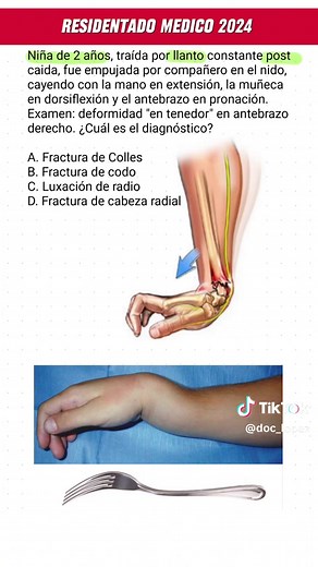 Resolución del Residentado Médico 2024 - Traumatología (Fractura de Colles) #enarm #residentadomedico #fracturadecolles #colles #traumatologia